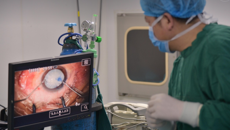 백내장 수술하는 사진