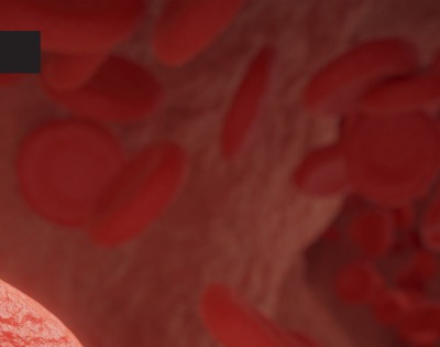 관상동맥 석회화 증상