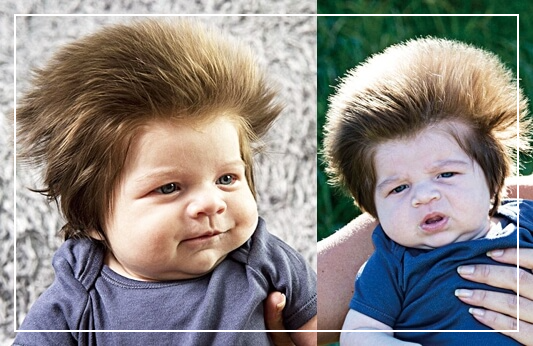 머리숱많아지는방법