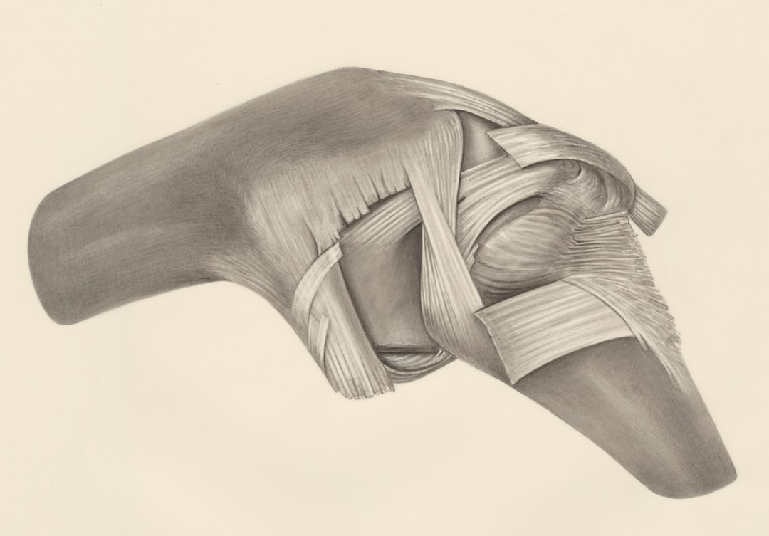 Arthritis