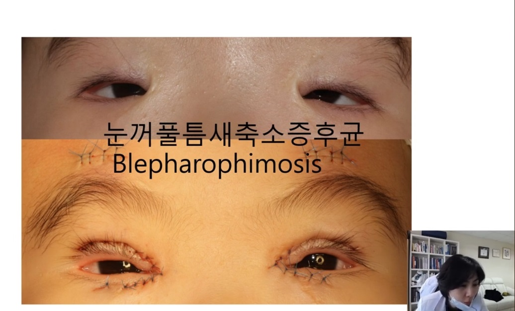 성형안과-윤진숙-교수
