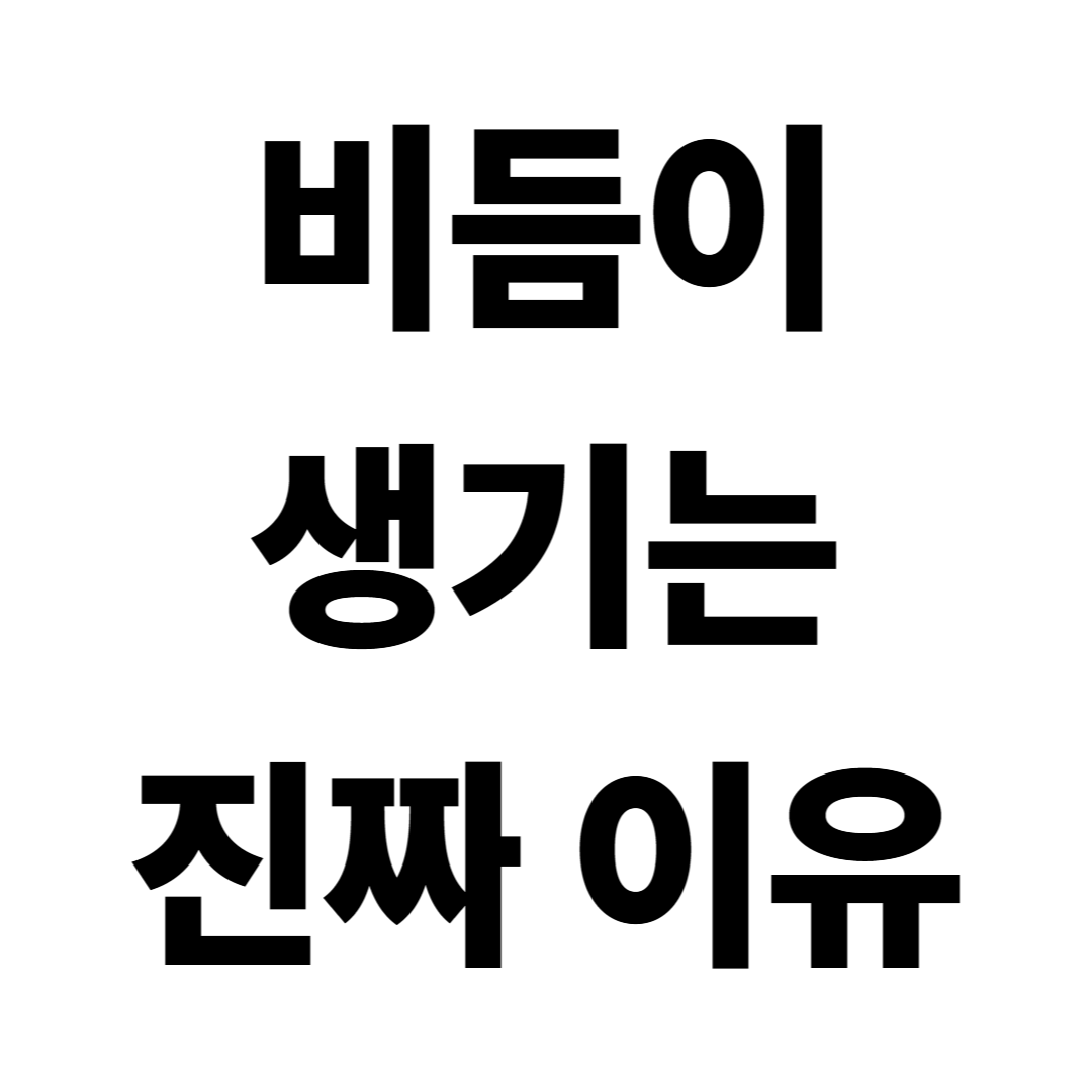 비듬이 생기는 이유|머리를 안 감아서만은 아닙니다