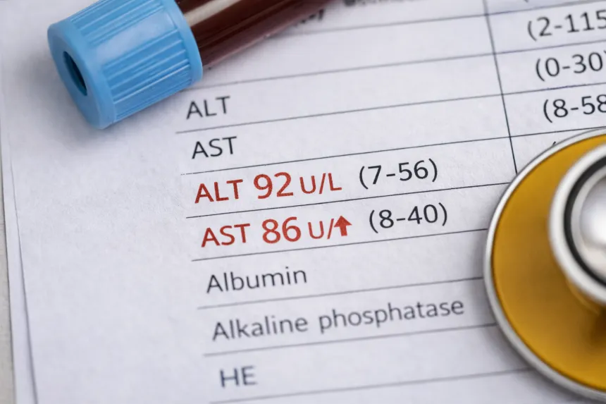 고지혈증 약의 부작용