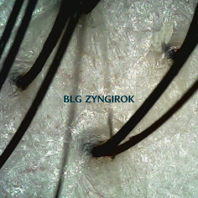 탈모 극복 프로젝트 - 뒷머리 두피 모습이다.