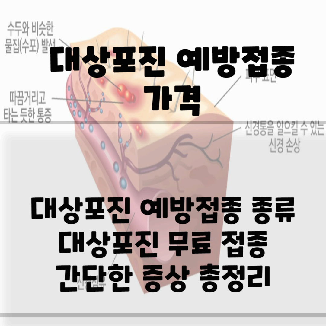 대상포진 예방접종 가격, 무료 접종(2023 최신) 블로그 썸네일 사진