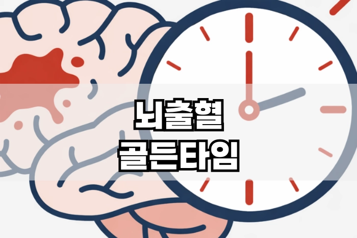 뇌출혈 골든타임