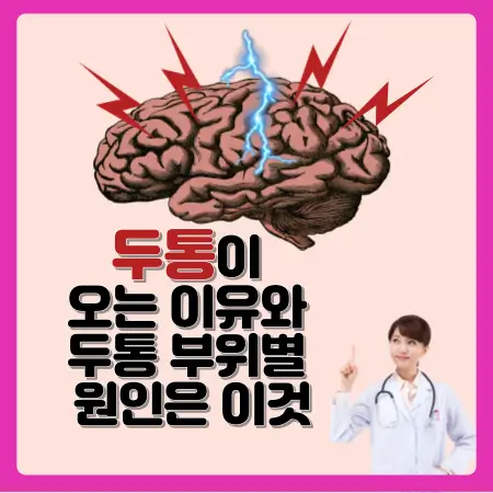 두통이-오는-이유와-두통-부위별-원인은-이것