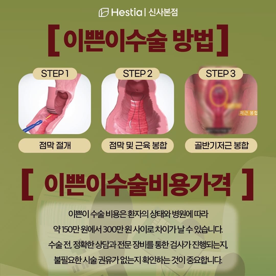 이쁜이수술비용가격은 왜 차이나나요?