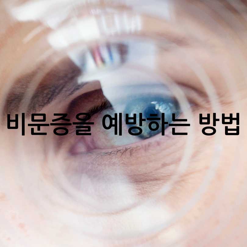 비문증(날파리증)