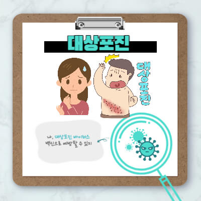 대상포진 초기증상