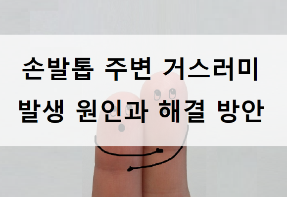 손발톱 주변 거스러미 발생 원인과 해결 방안