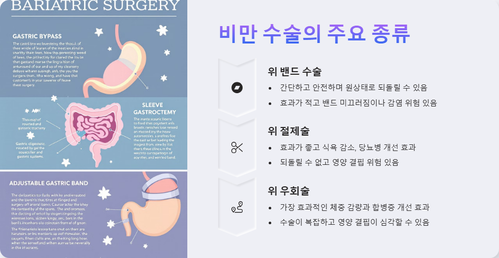 비만 수술 종류와 장단점 비교