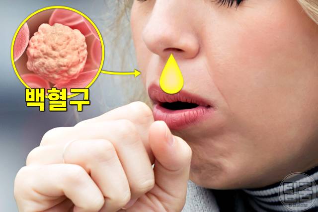 콧물 색깔별 증상,노란색 콧물 색깔로 보는 건강