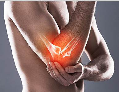 팔꿀치 엘보우 통증