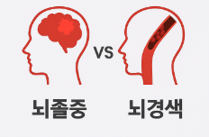 뇌졸중과 뇌경색