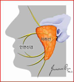 출처; 국가암정보센터, 이하선암 종양절제술