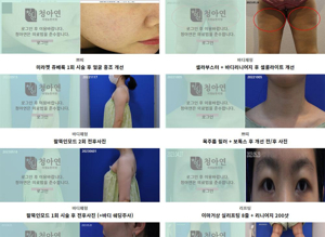 바디인모드
