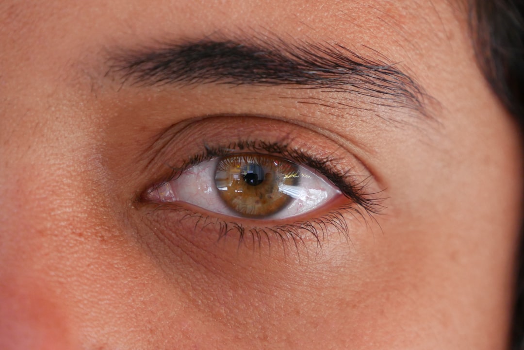 cataract