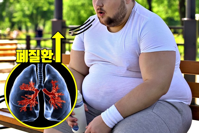 뱃살 내장지방 확인,팁줌