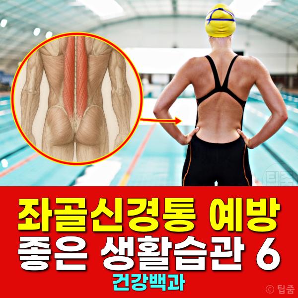 좌골신경통 예방 습관 운동 수면자세