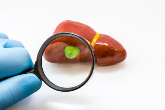 담낭암(Gallbladder Cancer): 원인, 증상, 진단 및 치료
