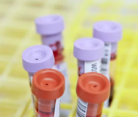 갑상성 기능 항진증 혈액검사 진단기준 치료법