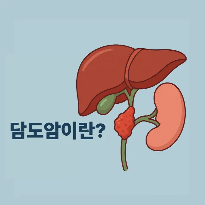 담도암이란