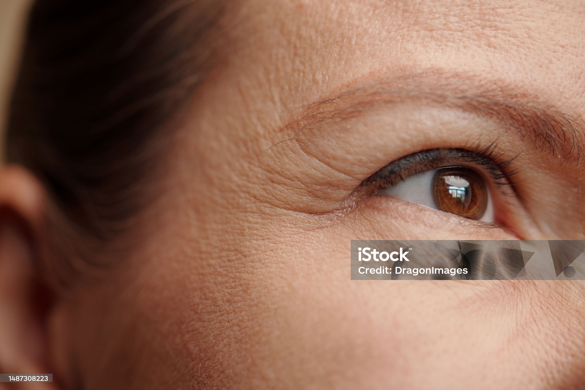 마리오네트 주름을 관리하는 다양한 방법