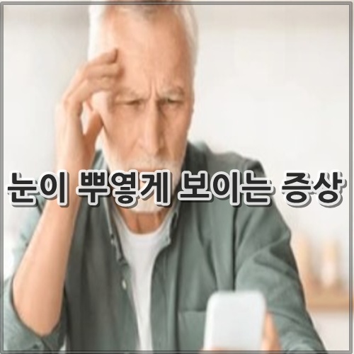 눈이 뿌옇게 보이는 증상