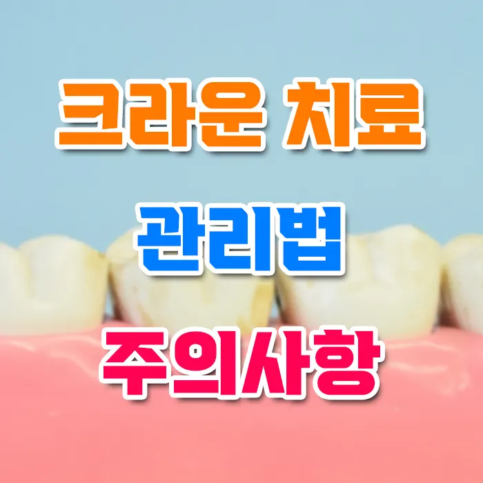 크라운 치료 관리법 주의사항