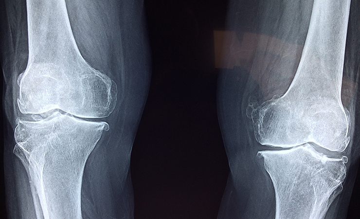 정형외과 아픈 증상