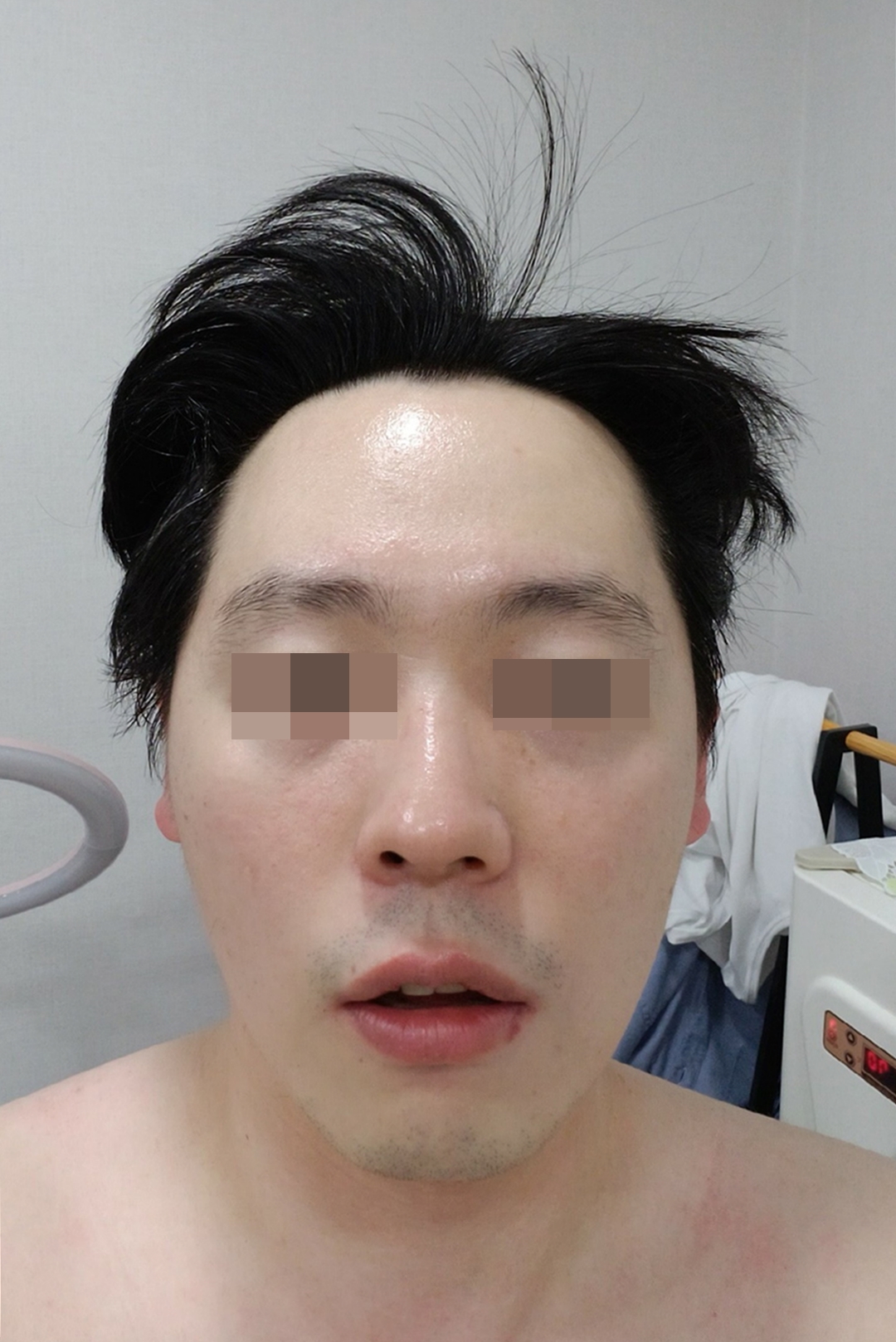 피부물광관리