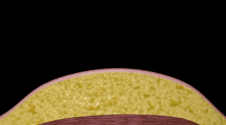 뱃살-지방-사진