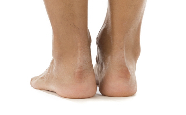 콜레스테롤 높으면 나타나는 증상