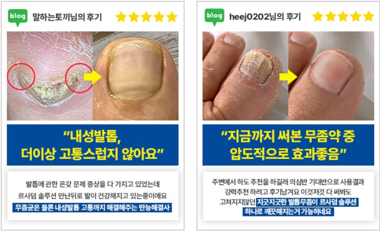 르사덤 발무조메 솔루션