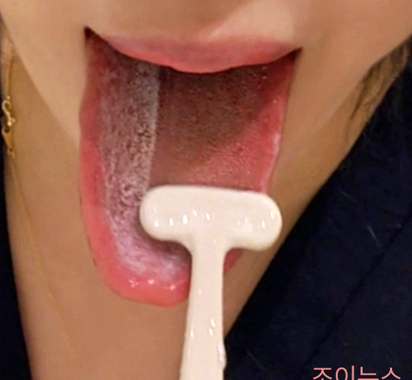 혀클리너_이미지출처:쿠팡