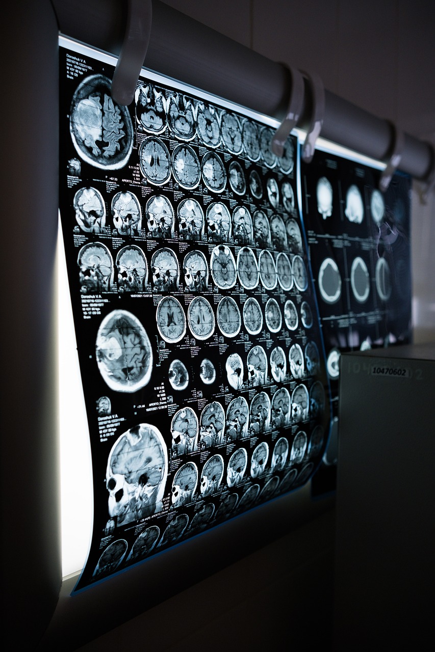 MRI 결과지