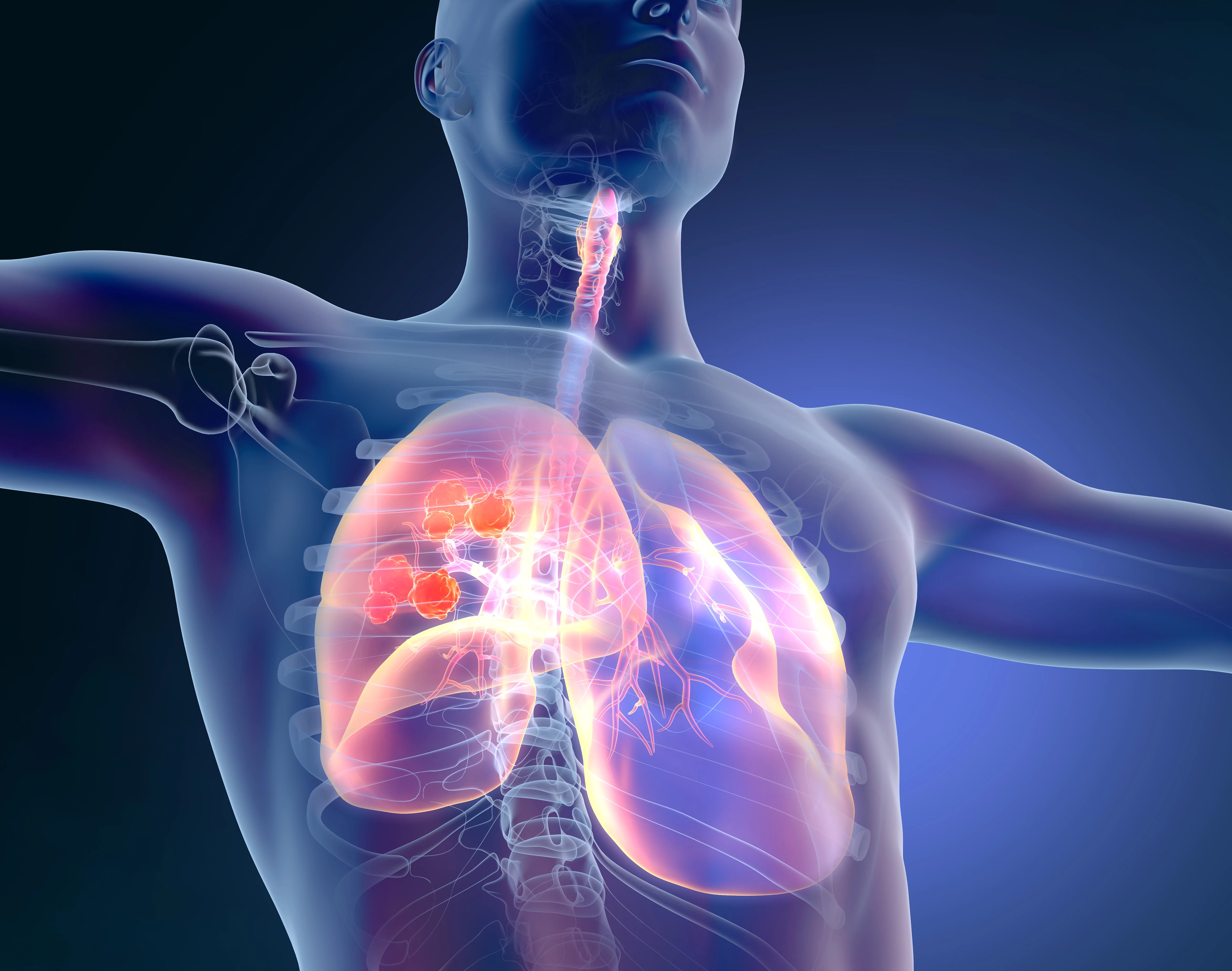 유한양행 렉라자: 3세대 폐암 치료제, FDA 승인 획득