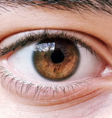 황반변성 치료법 자가진단 방법 합병증