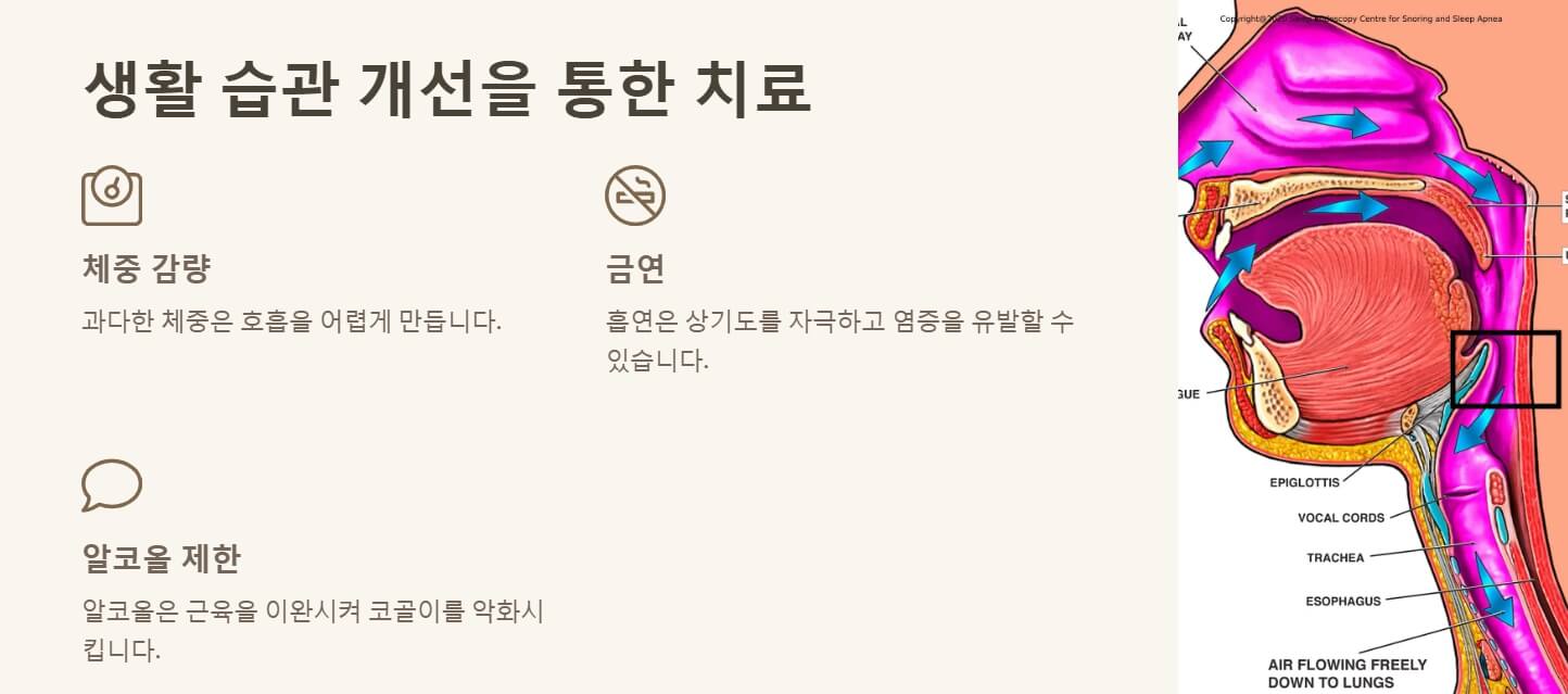 코골이 치료법
