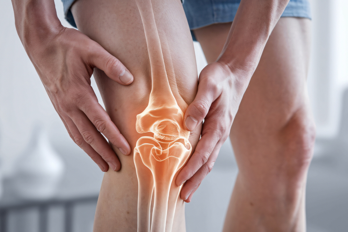 보스웰리아 효능