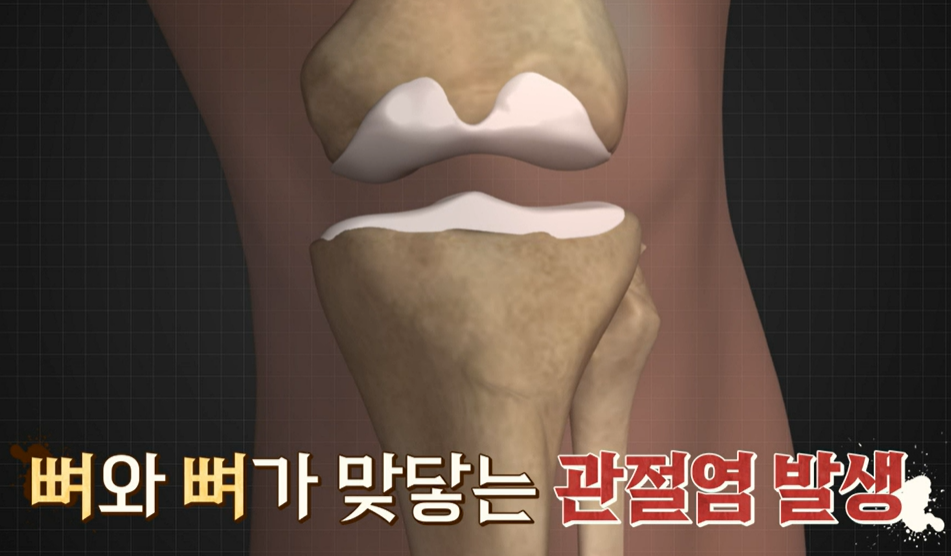 콘드로이친