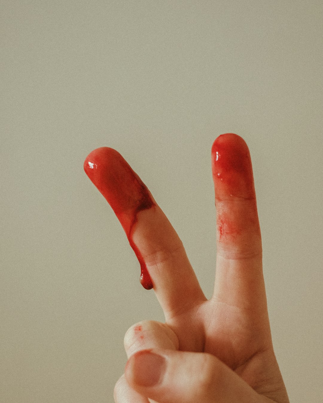 생리늦어짐: 원인과 대처 방법 총정리 관련 이미지 1