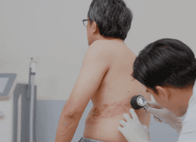 대상포진 예방접종 가격