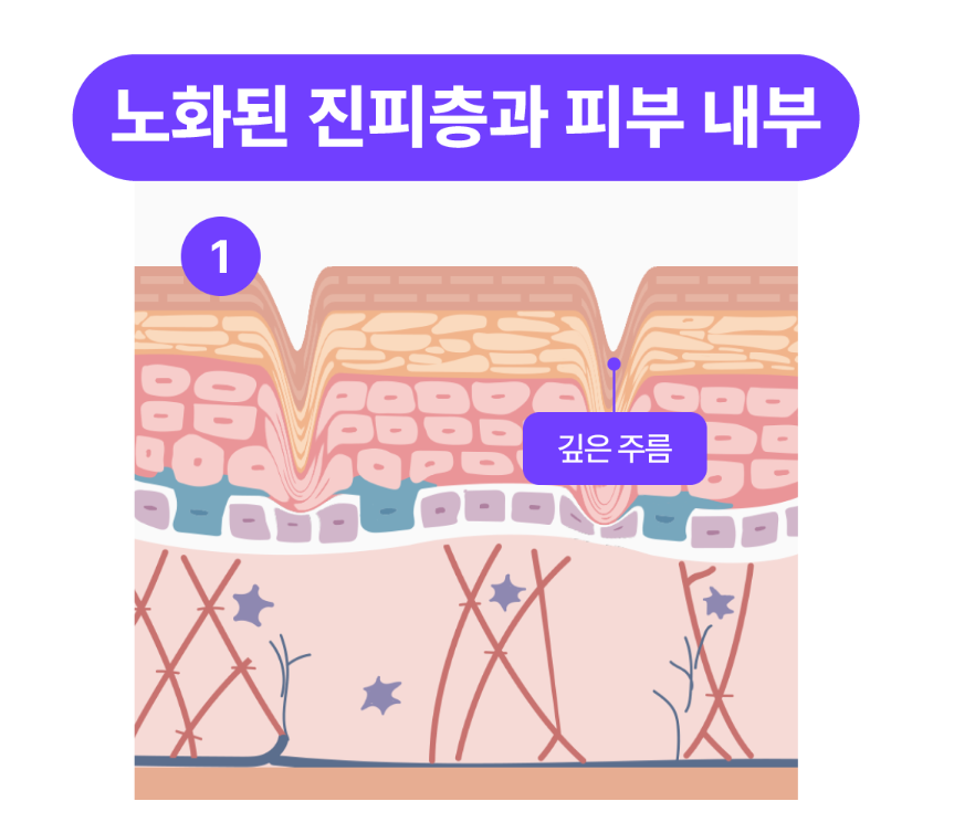 논현역성형외과 베네핏주사