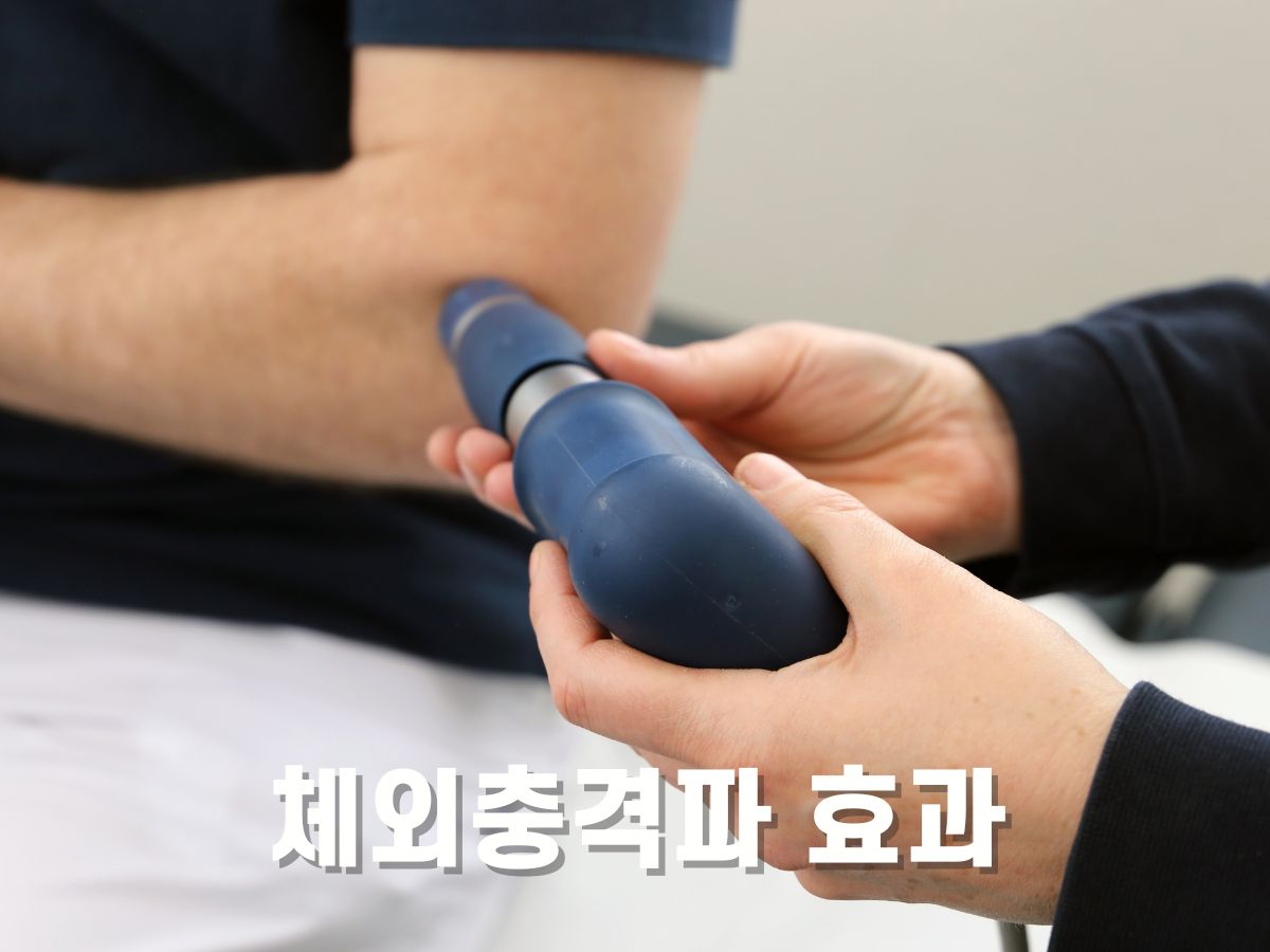 체외충격파 치료 효과