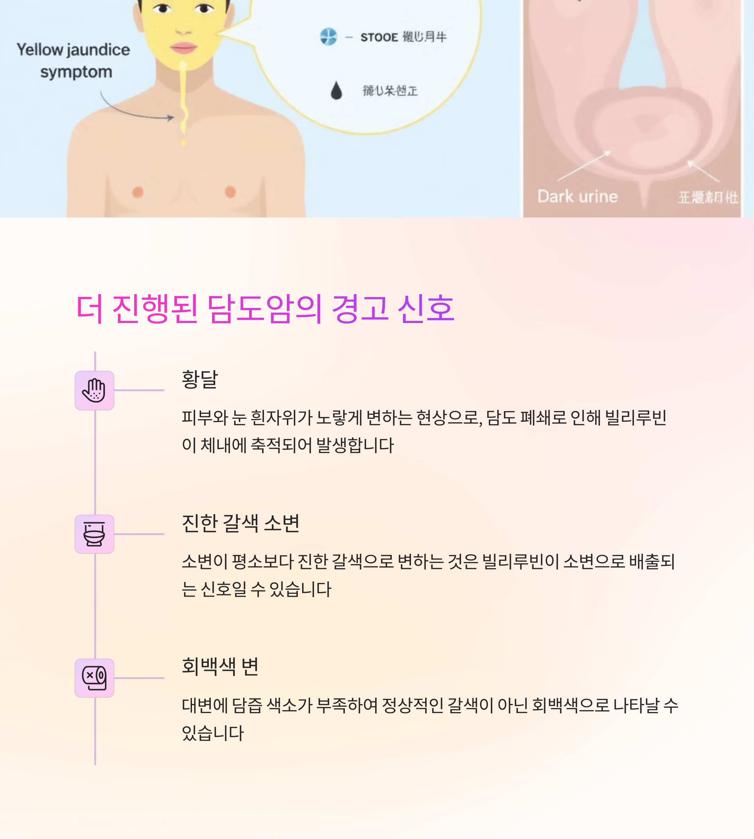 담도암 증상 초기단계 신호
