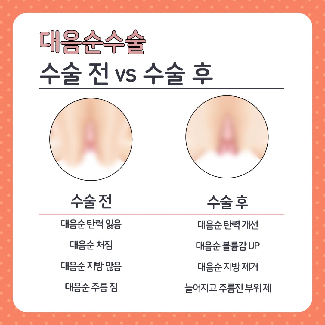 외음부가려움증
압구정산부인과