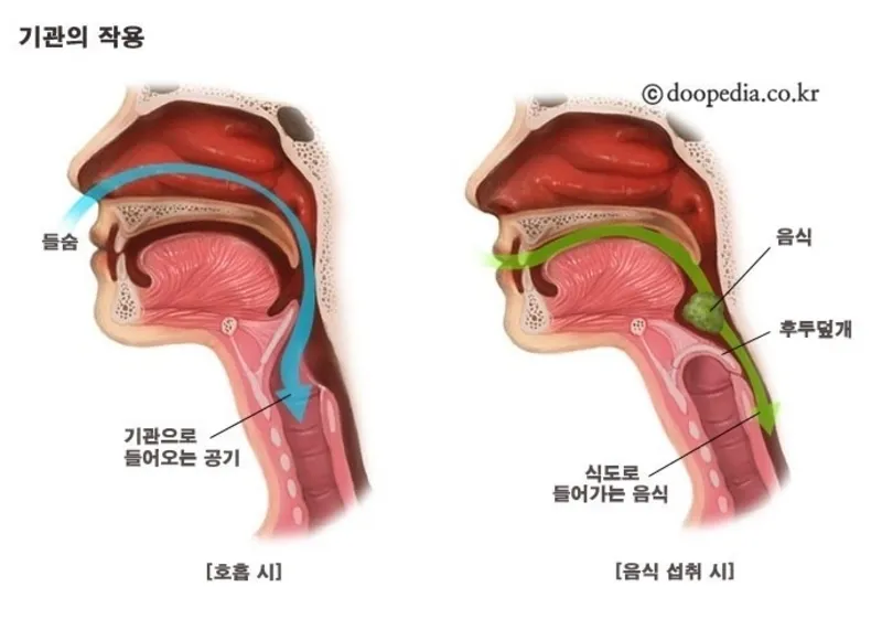사레들리다 사레걸리다 사래들리다 맞춤법_4