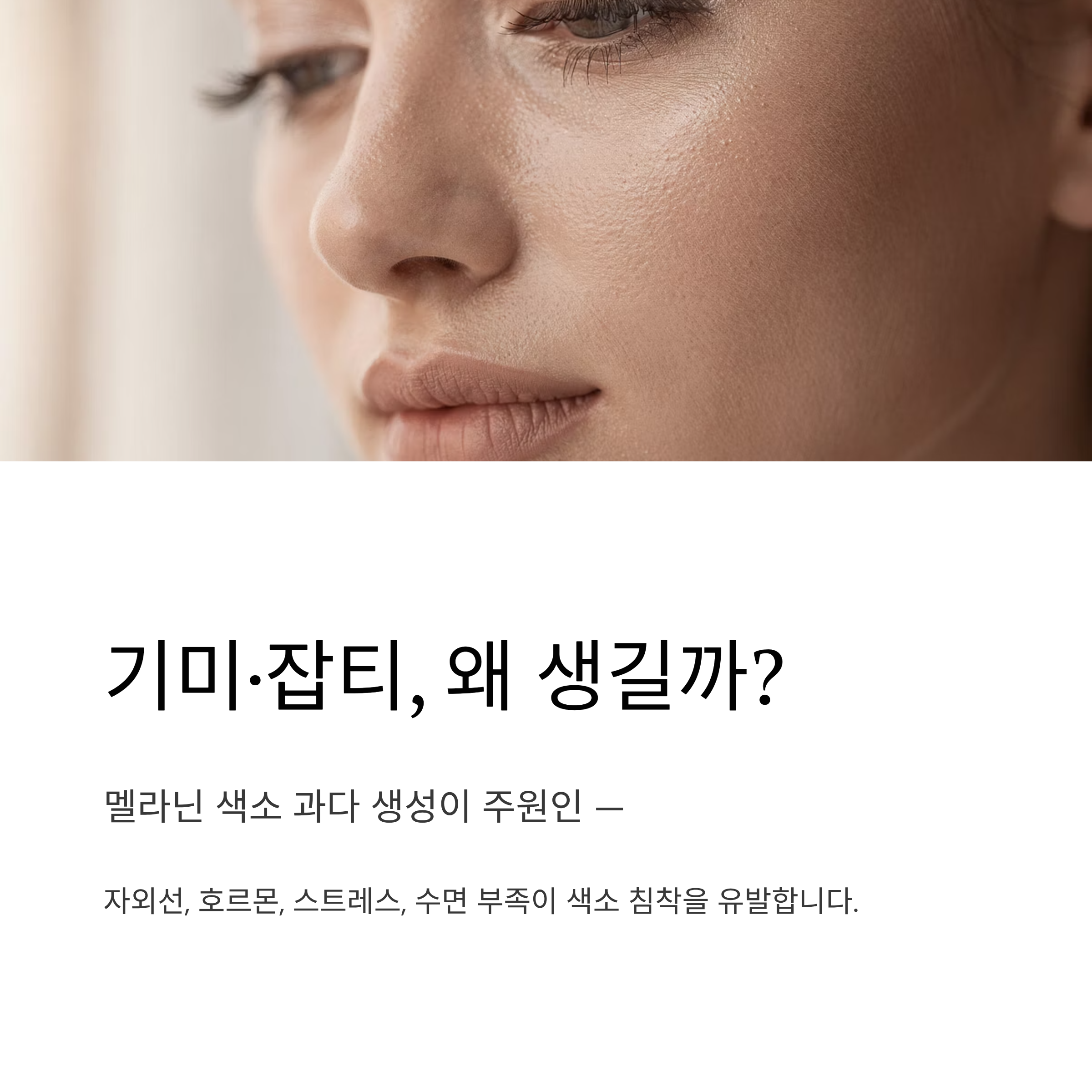 기미 잡티 발생 원인